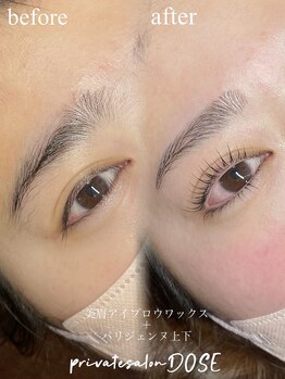 ドース(DOSE)/すっぴんでも最高！