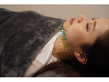 コガオ レンネ(Lenne)の写真/《加古川駅近》 美容鍼でお肌のくすみ、お肌のむくみ、お肌のハリを改善♪