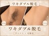 【黒いポツポツ卒業】★脇ダブル脱毛★【女性5,000円、男性7,000円】