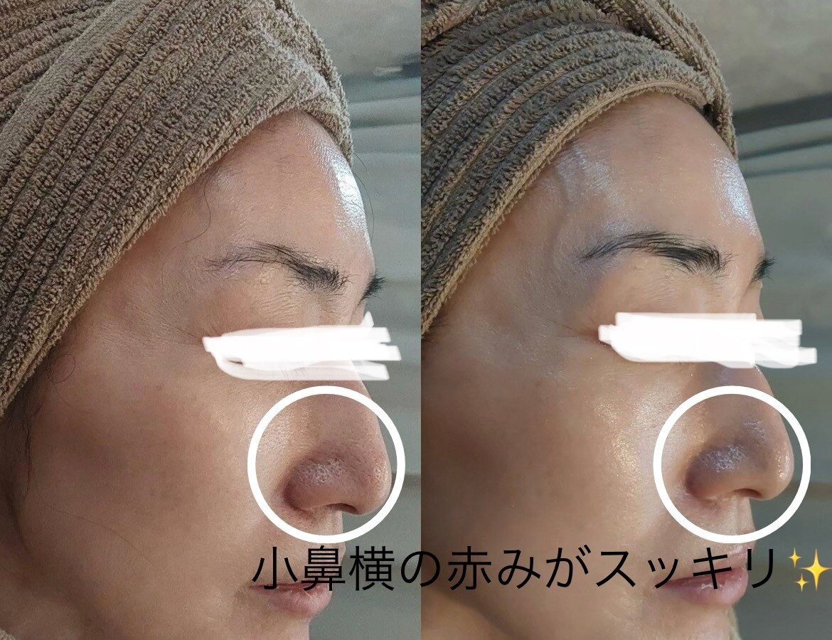 ミミアザブ(MIMI AZABU)｜ホットペッパービューティー