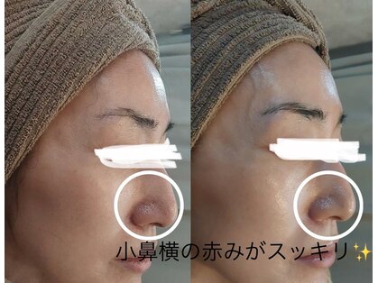 ミミアザブ(MIMI AZABU)の写真