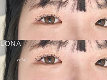 ロナ(LONA)の写真/まつげの負担を軽減し、ボリュームのある目元で魅力UP!お悩みに合わせて施術いたします♪