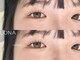 ロナ(LONA)の写真/まつげの負担を軽減し、ボリュームのある目元で魅力UP!お悩みに合わせて施術いたします♪