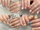エムジーネイル(Mg Nail)の写真