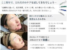 ビアンカ