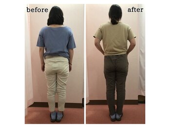 香里園かほりまち整骨院鍼灸院/産後骨盤矯正