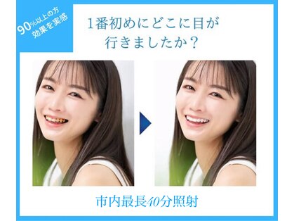 ホワイトニングショップ 長岡京店の写真
