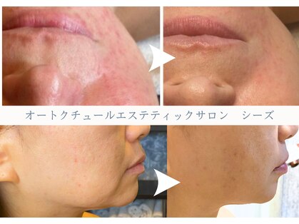 オートクチュール エステティックサロン シーズの写真