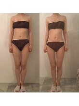 ピカケ(PIKAKE)/筋膜リリース