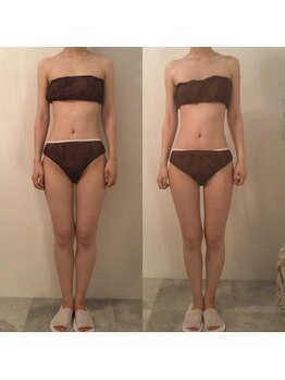 ピカケ(PIKAKE)/筋膜リリース