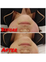 カイロプラクティックひまわり/小顔矯正