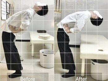 ナオル整体 国分寺院(NAORU整体)/20代男性【股関節の違和感】