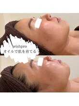 エミナル(EMINALu)/無加工でこの艶が叶う