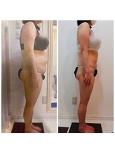 アイディエム 新宿店(IDM)/【モニター】160ｃｍ・20代