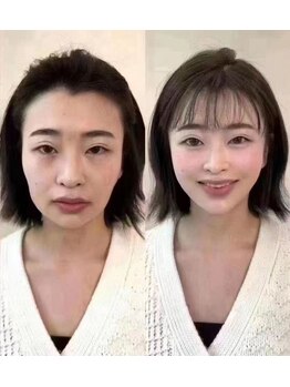 協和アロマ美容サロンの写真/【ハリツヤＵＰ】ハンド電気美容＋小顔コルギフェイシャル90分12800円→6980円(新規)