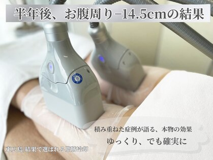 ルーチェ カリーノ(Luce Carino)の写真