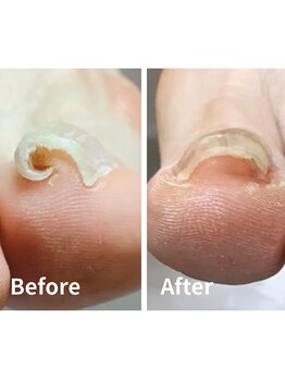 リゼラアンドコー 相模大野店/ドイツ式フットケア専門店