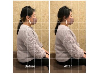 トラスト整体院 小池院/30代/女性/デスクワーク/不眠