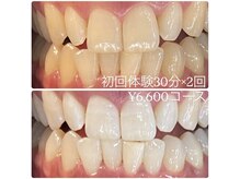 ホワイトニングルーム 横浜店(Whitening Room)/セルフホワイトニング/横浜