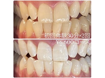 ホワイトニングルーム 横浜店(Whitening Room)/セルフホワイトニング/横浜
