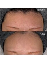 ビオエル(Bioell)/フィルターいらずの美肌に！