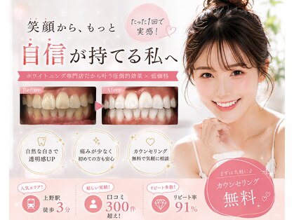 LBSホワイトニング 上野店の写真