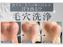 レベンディス(LEVENDIS)