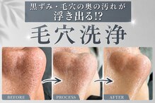 レベンディス(LEVENDIS)