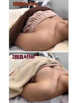 ブライトプラス 姫路店(Bright plus)の写真/ハリUP＆ふわふわ美バストケアで整える！コリも解消しながら理想の美胸を目指しませんか？