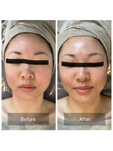 ソルーチェ(soluce)/小顔になりたい人必見♪