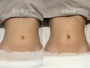 ヴィディトゥ(vidyto)/BODY【便秘・腸活・ぽっこり】