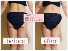 ヨサパーク シュエット(YOSA PARK CHOUETTE)/ヒップアップ！！