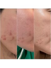 アイ クイーン 押上店(Eye queen)/