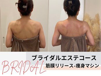 ミルズ 天神店(MillS)/ブライダルエステコース