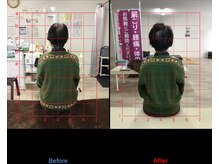 ストレチックス 近江八幡店/姿勢・腰痛改善ビフォーアフター