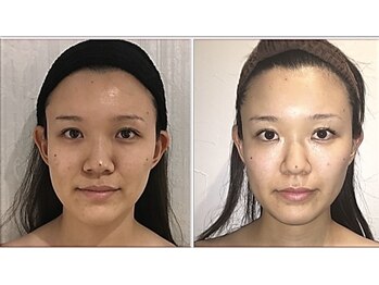小顔整体研究所 KSラボ 藤が丘店/