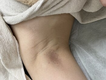 ナノハナ/鹿沼市の全身脱毛美容室ナノハナ