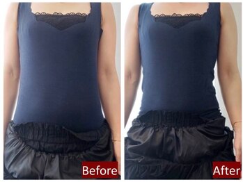 岩田整骨院神経整体院/【トランスビート】寝るだけ痩身