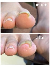 パスリー ネイルアンドケア(Parsley Nail&Care)/