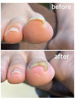 パスリー ネイルアンドケア(Parsley Nail&Care)/