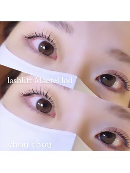 シュシュ(chou chou)/メーテルロッド