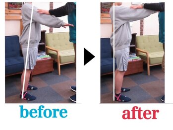 オレンジ整骨院/バランステスト1