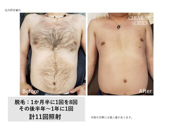 フェレザ 新潟(Felleza)/短期間で完了したい方に◎