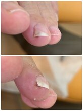 巻き爪じゅん 千葉駅前店/丁寧なケアで快適な毎日へ