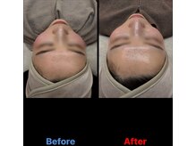 クラルテアンドコー(Salon Clarte&Co.)/ダクトピール◎