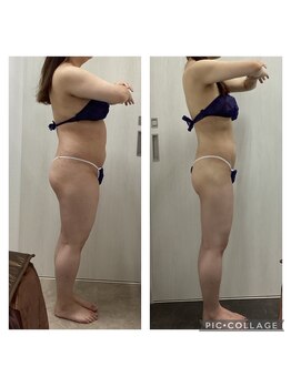 リオンズ 柏駅前店/6ヶ月痩身通い放題+セルバーン