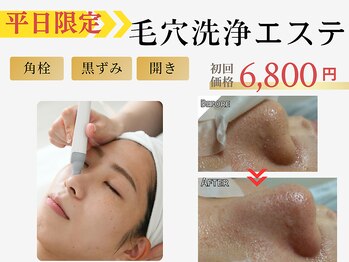 ルネ(Rune)の写真/メイク崩れが気になる方オススメ!【初回40分￥6,800毛穴洗浄エステ】毛穴の角栓・ざらつき一掃!いちご鼻卒業