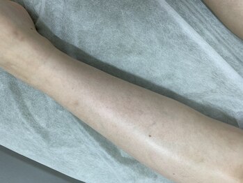 ナノハナ/鹿沼市の全身脱毛美容室ナノハナ