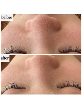 メナードフェイシャルサロン 岐阜茜部/ビューネケアパック