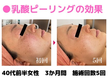 ラディアント たまプラーザの写真
